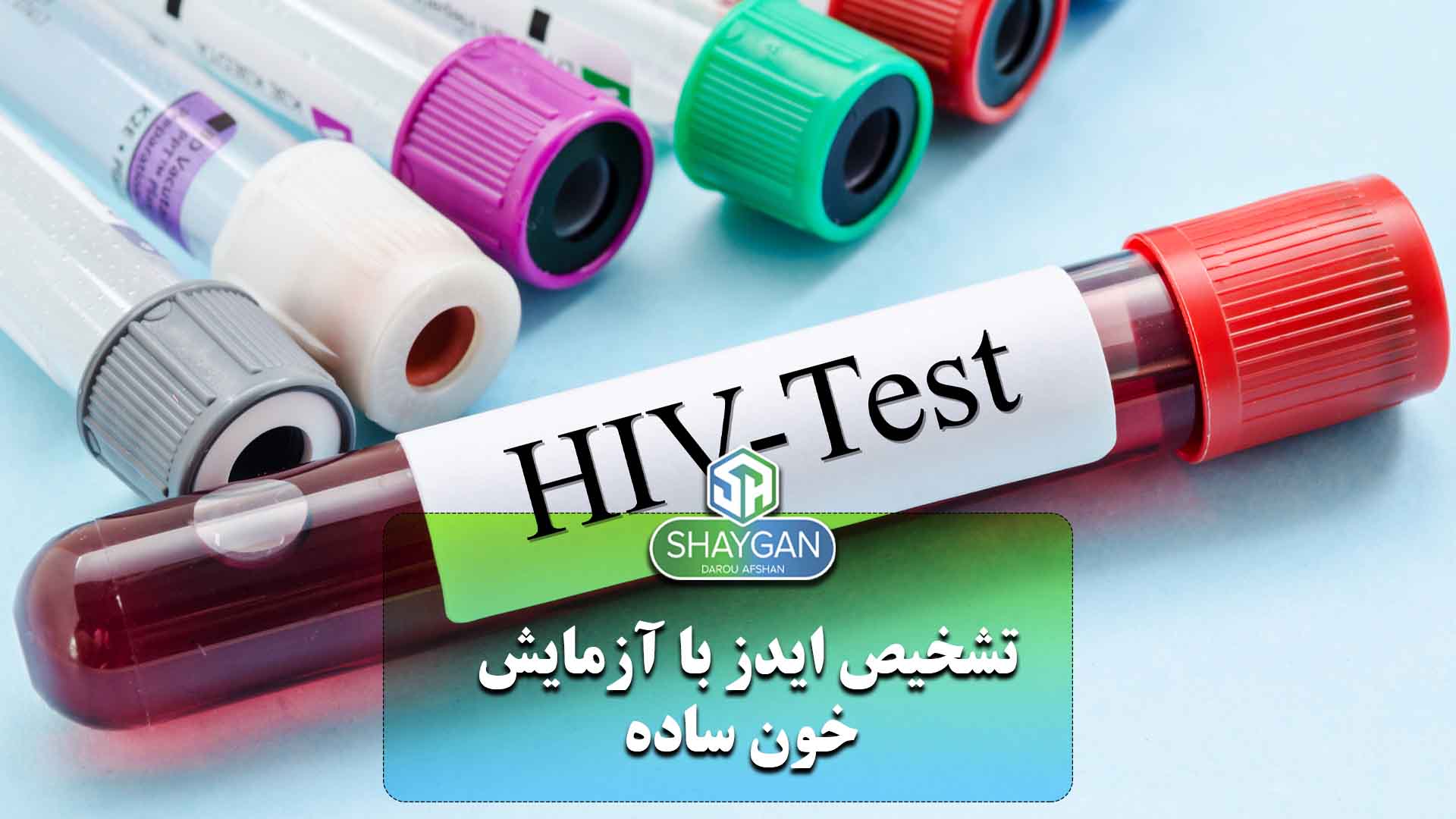 تشخیص ایدز با آزمایش خون