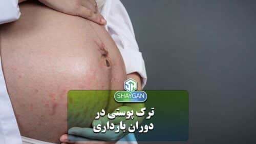 ترک پوستی در بارداری