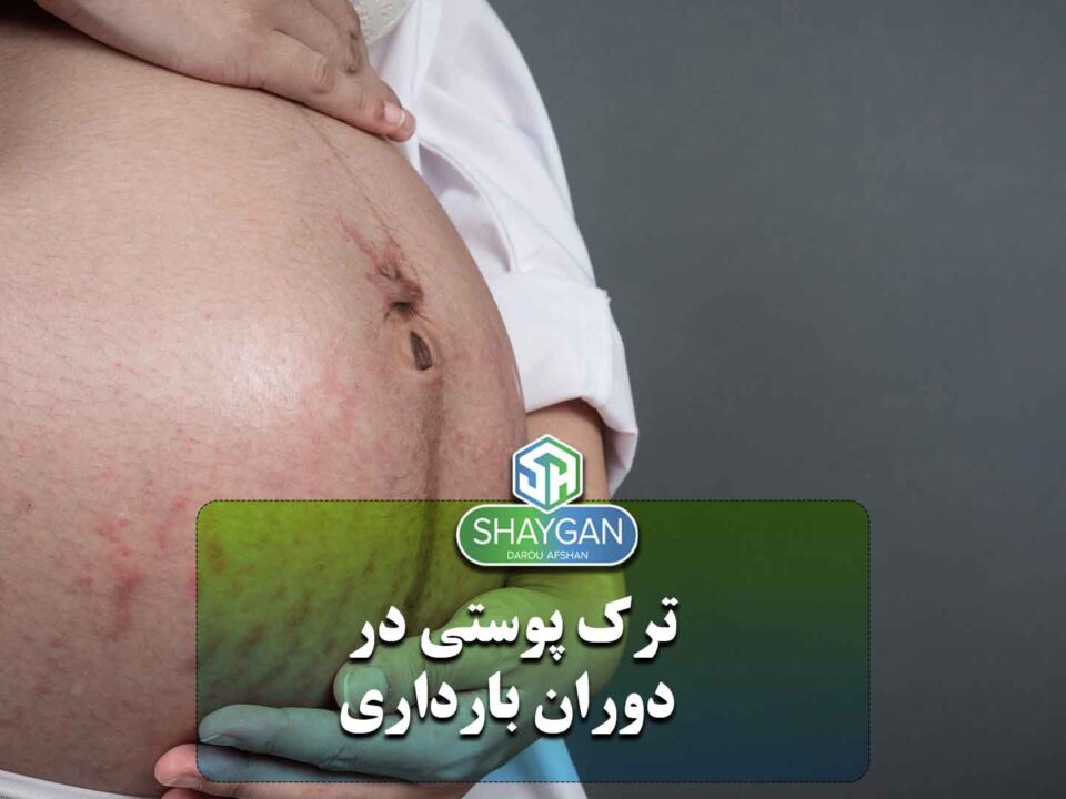 ترک پوستی در بارداری