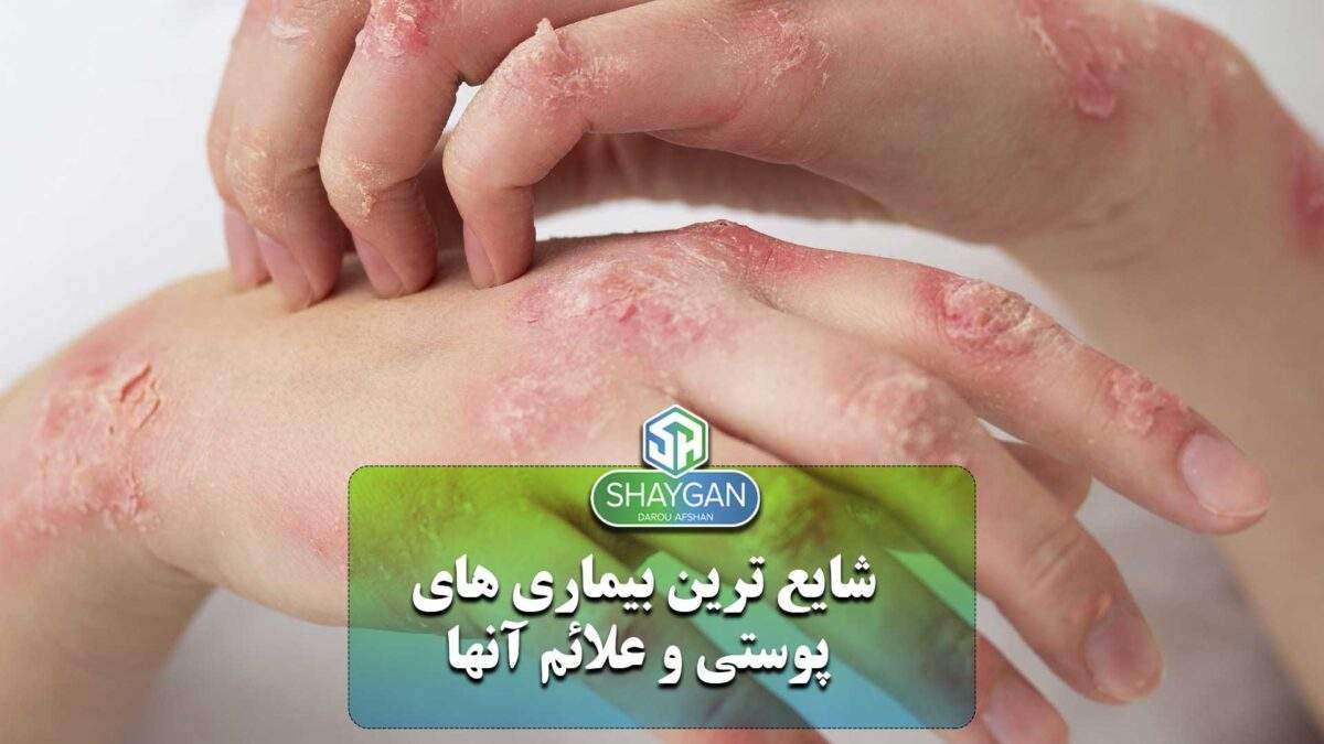 شایع ترین بیماری های پوستی